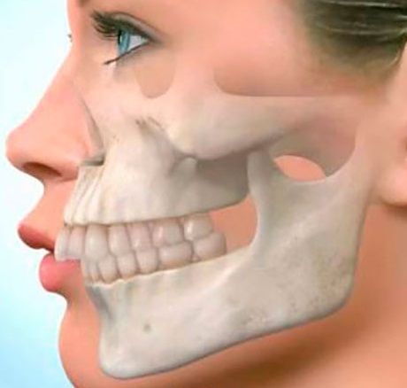протезирование верхней челюсти при частичном отсутствии зубов цена