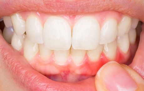 почему болит десна после пломбирования зуба