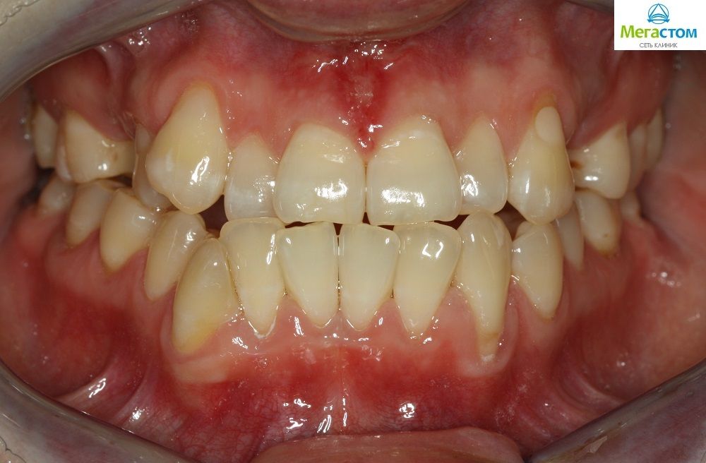 Искусство выравнивания зубов – психологический аспект