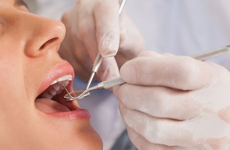 Возможно ли лечение кариеса без сверления зубов?