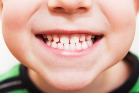Оксана Мальцева: что делать, если после ортодонтического лечения у ребенка стали расползаться зубы