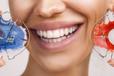 Владимир Лосев: ортодонтические пластинки для выравнивания зубов помогут исправить прикус