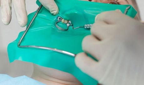 Терапевтическая стоматология лечение кариеса