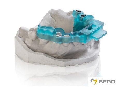3D-хирургический шаблон для имплантации зубов