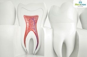 Корневые каналы зуба